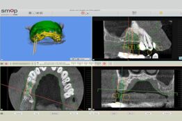 Moderne Technik in der Praxis für Mund-, Kiefer- und Gesichtschirurgie